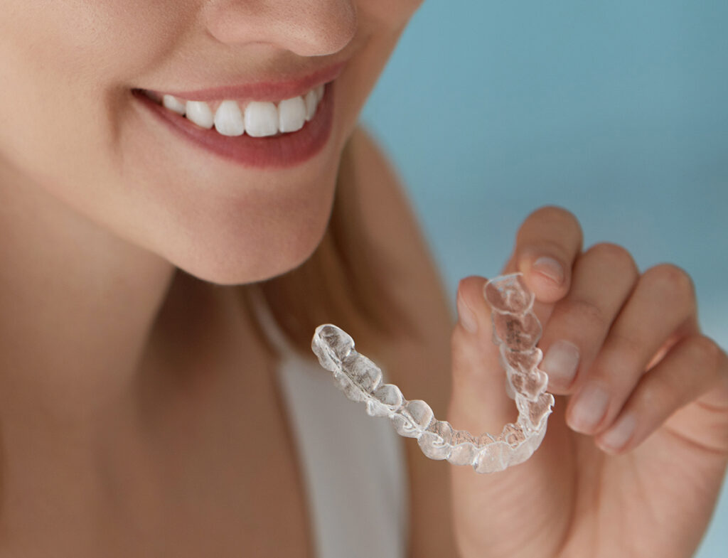 Klinika Sypsena ortodontinis gydymas kapomis