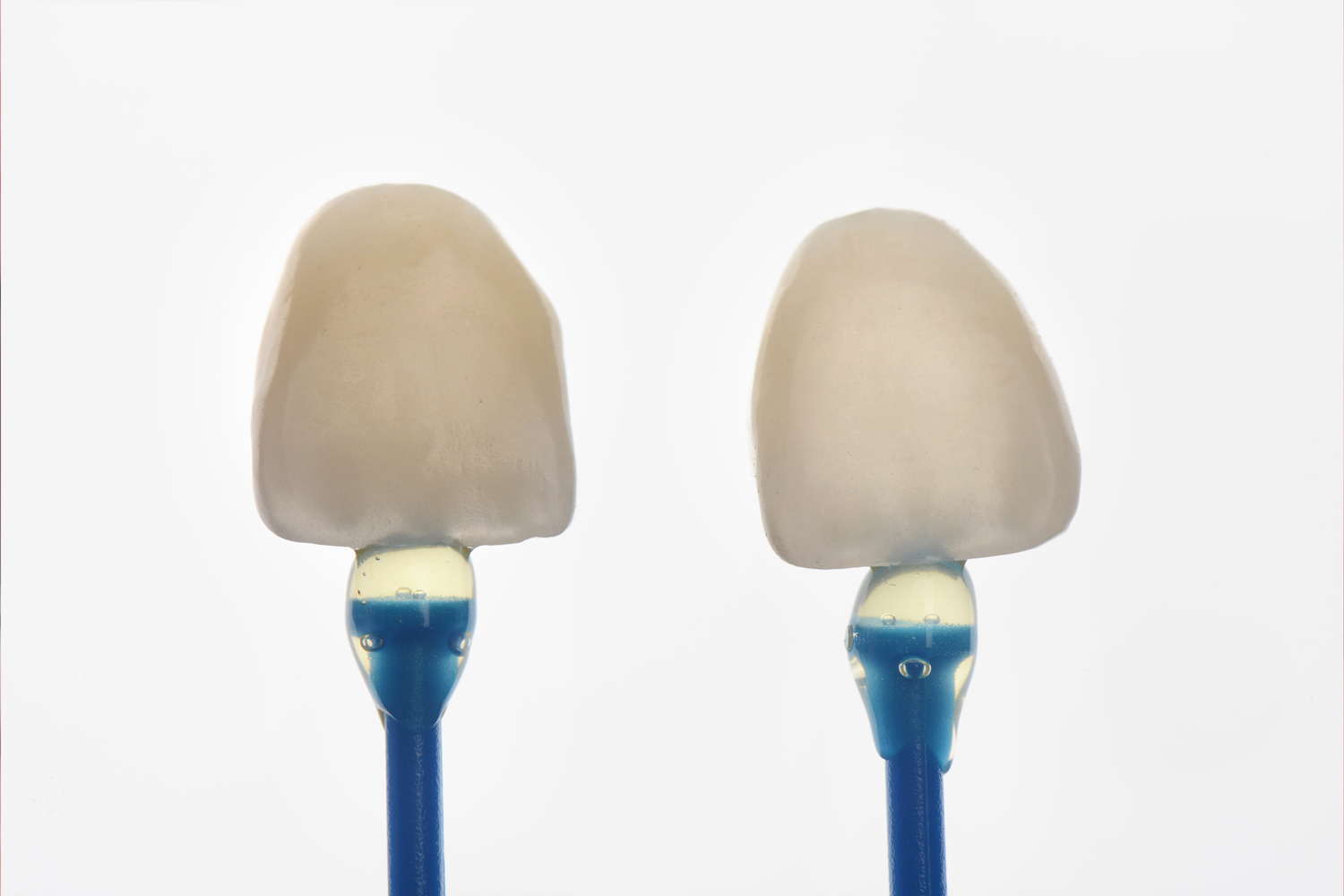 klinika sypsena dantu laminates