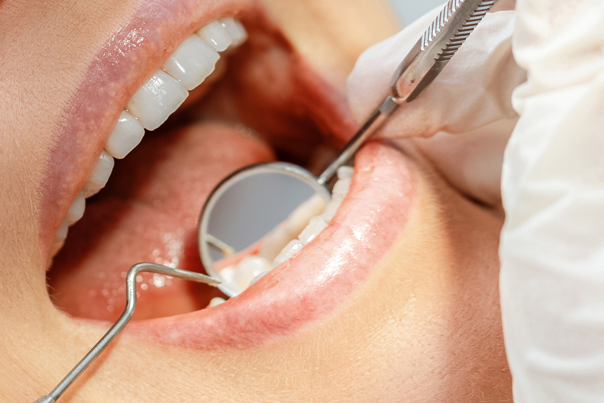 odontologijos-klinika-sypsena-affidea-pacientams-panevezys