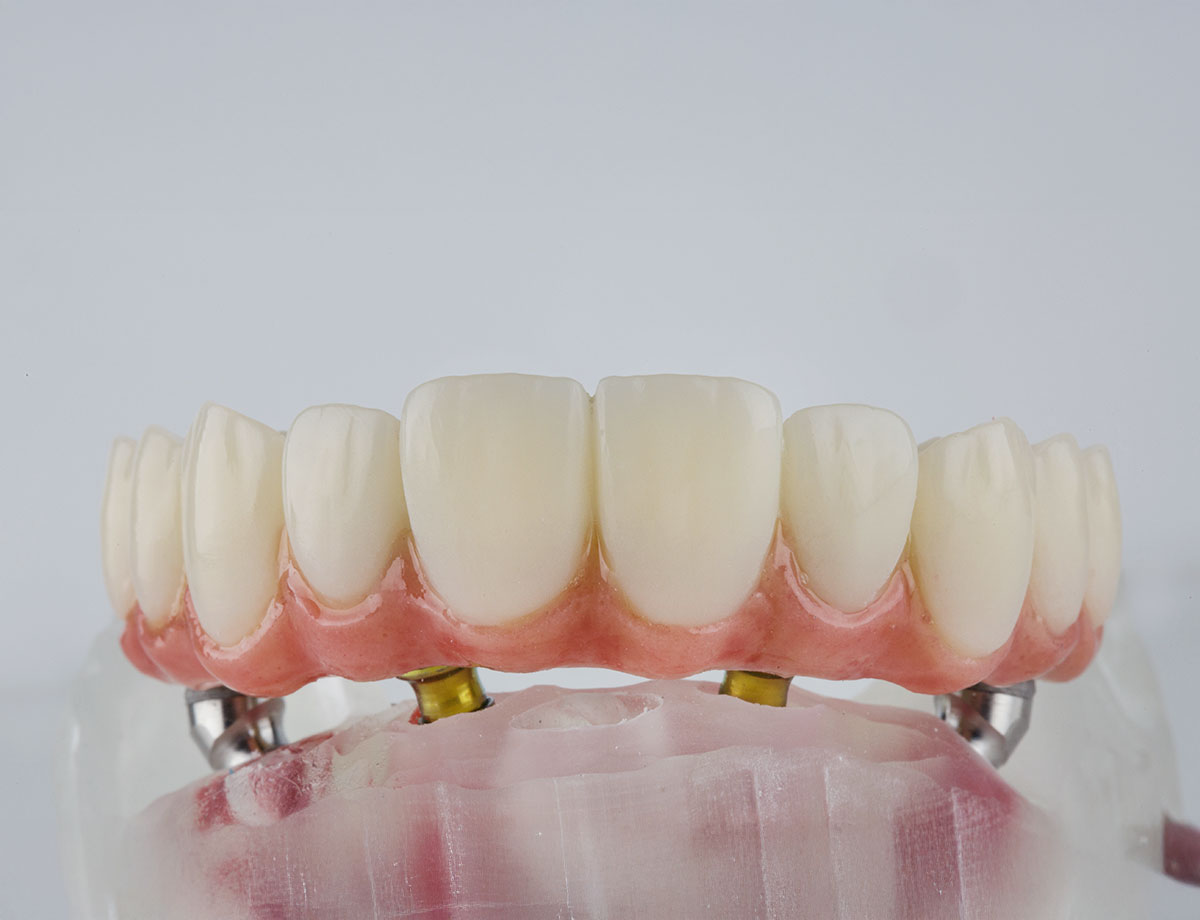 paslauga Klinika Sypsena all on 4