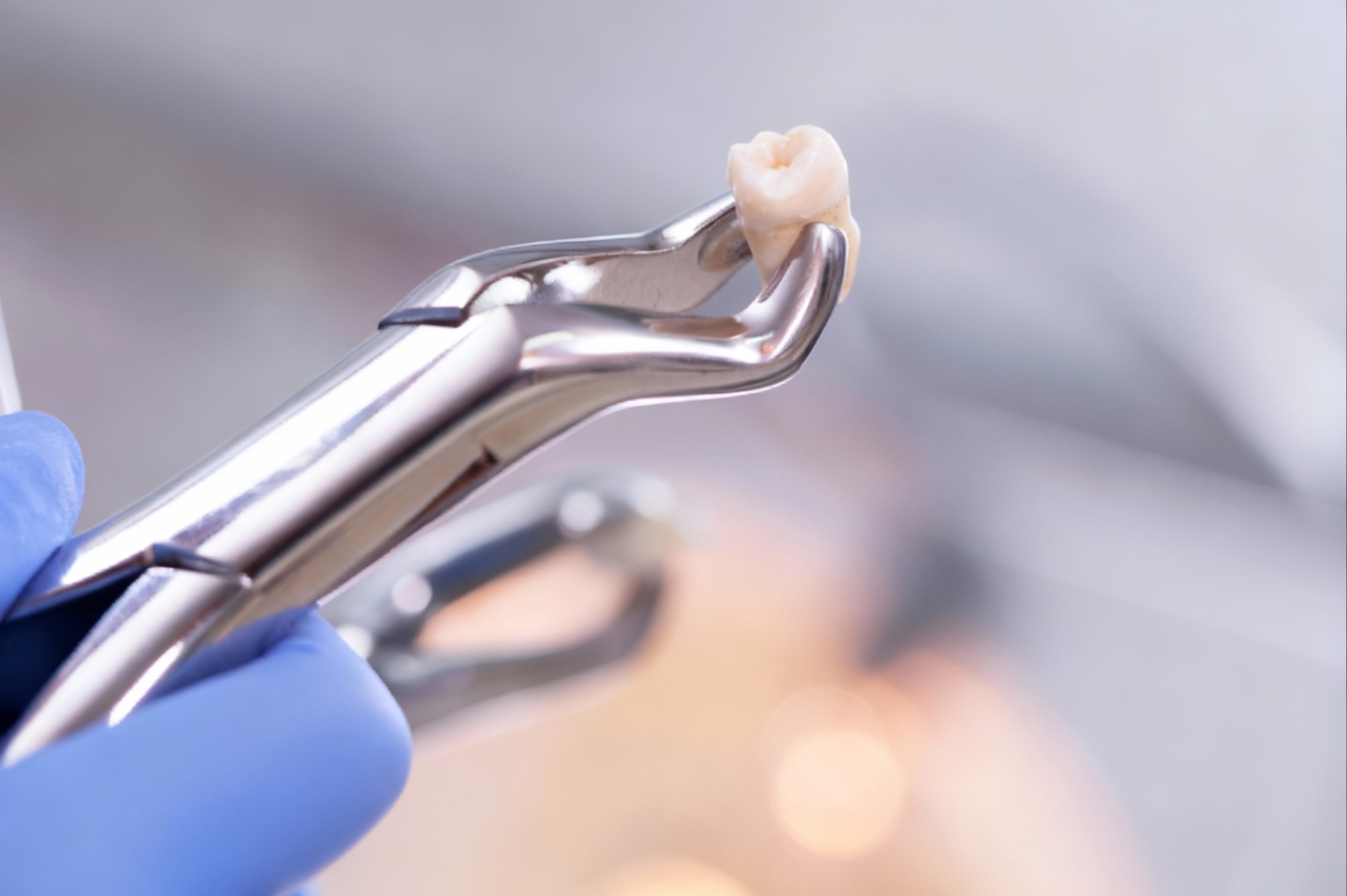 sypsenaok klinika dantu salinimas 3