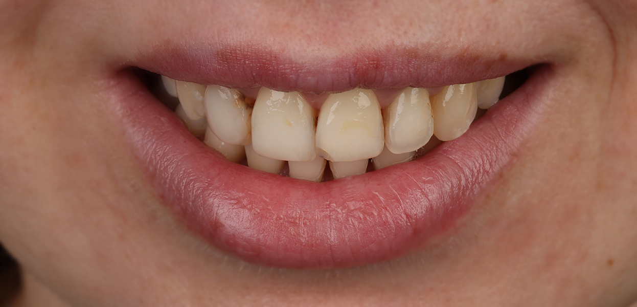 sypsenaok main pries