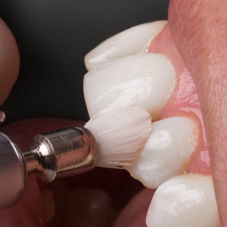 klinika_sypsena_burnos_higiena