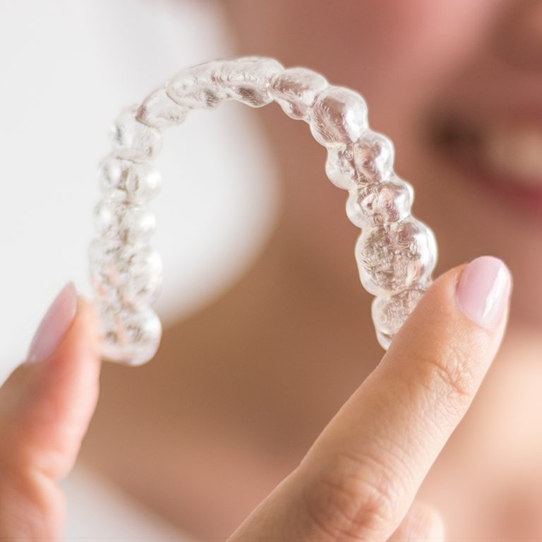 paslauga_Klinika-Sypsena-dantu-tiesinimas-ortodontinis-gydymas-kapos